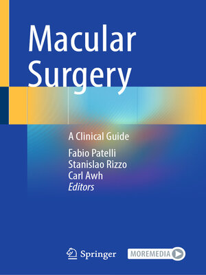 cover image of Macular Surgery